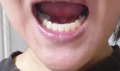 20151220selca.jpg