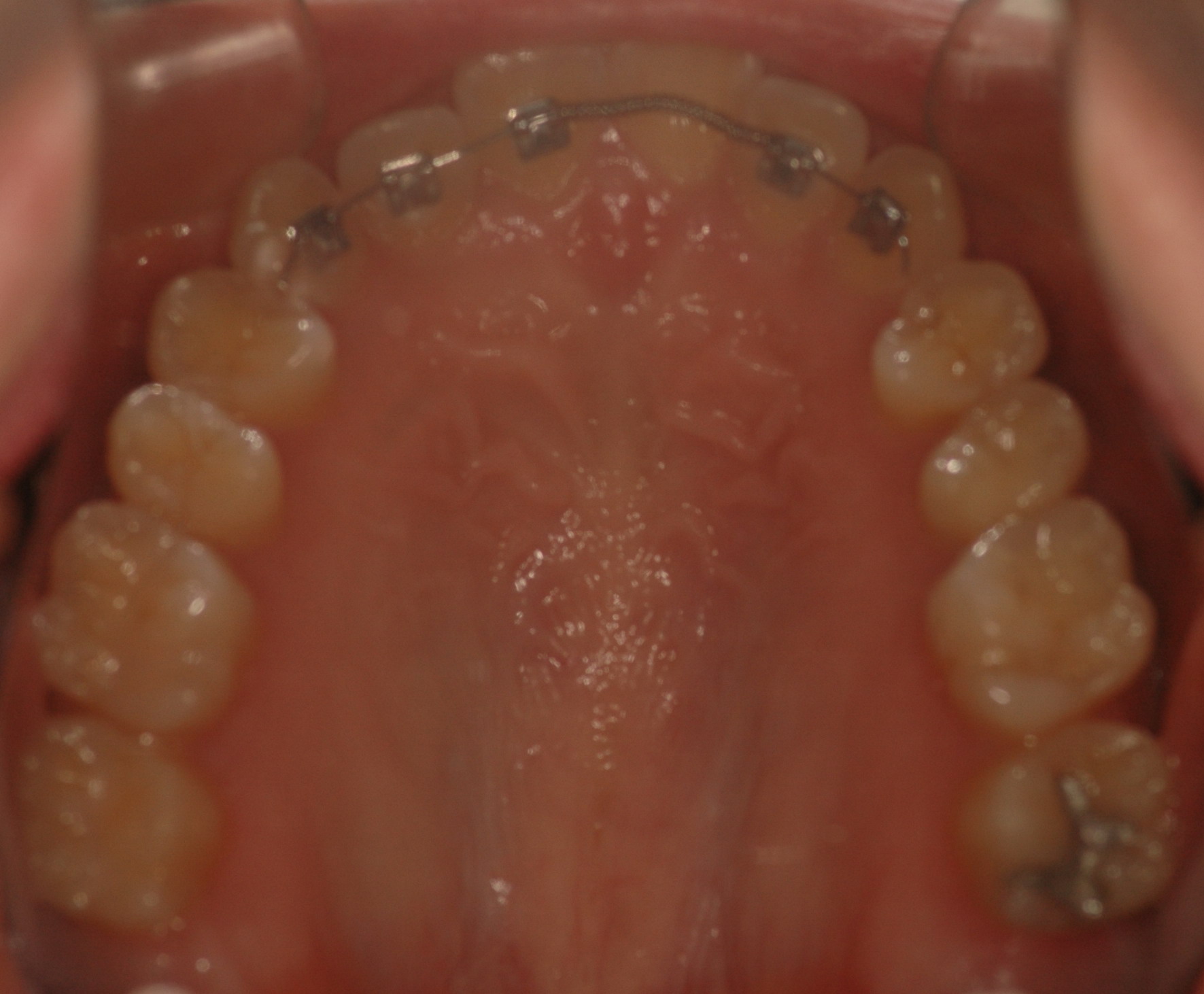 20110326 4.jpg