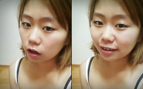 오라픽스 치아교정 포스팅(2).jpg