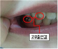 측면사진.jpg