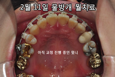 201602uphhh.jpg