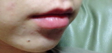 치아교정후기03.jpg