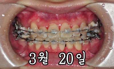 0320jung.jpg