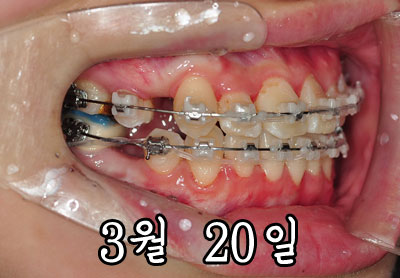 0320side1.jpg
