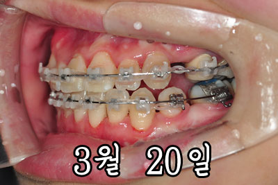 0320side2.jpg
