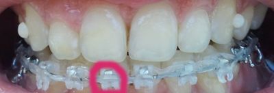 2011-11-16 13.50.06.jpg