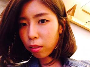 치아교정후기8.JPG