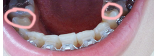 2011-07-14 09.22.32.jpg