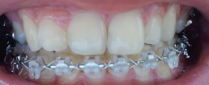 2011-07-14 09.21.20.jpg