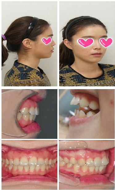 후기사진1.jpg