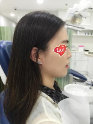 옆모습.jpg