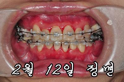 2월후기정.jpg