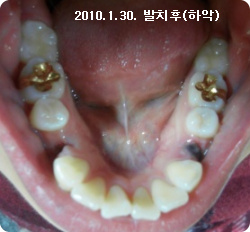 b3.jpg