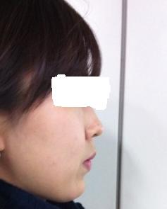 옆모습2.JPG