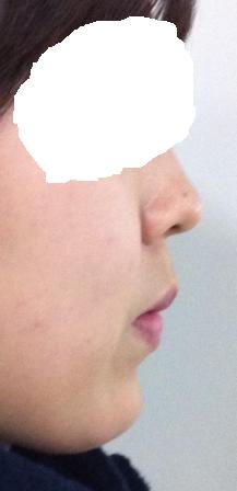 옆모습.JPG