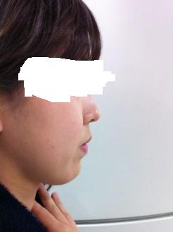 옆모습3.JPG