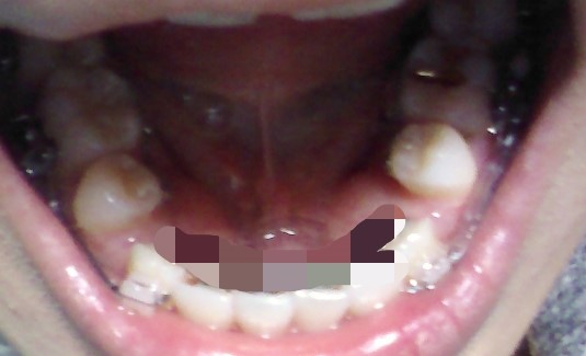 20150228_2044359.jpg