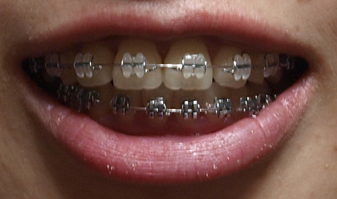 _5260510.JPG
