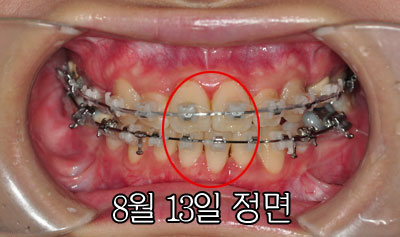 0813junghhh.jpg