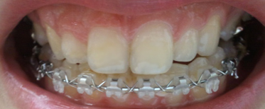 2011-04-27 09[1].28.14.jpg