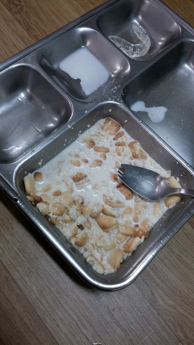 턱관절+치아교정후기3.jpg