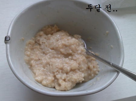 치아교정후기5.jpg