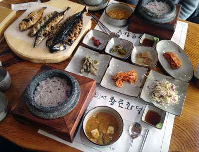 치아교정후기7.jpg