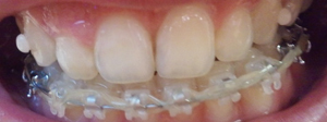 2011-10-26 07.37.59.jpg