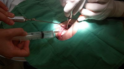 치아교정후기9화사진7.jpg