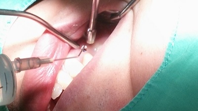 치아교정후기9화사진8.jpg