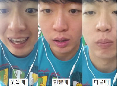 턱관절+치아교정4.png