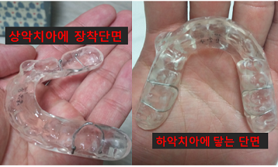 턱관절+치아교정2.png