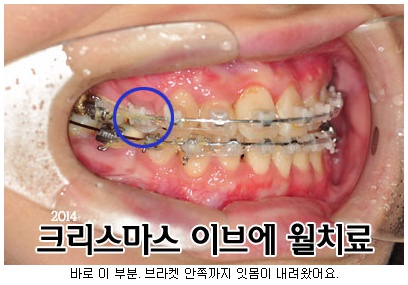 esamo_co_kr_20150223_013603.jpg