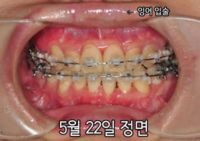 20150522h-jung.jpg
