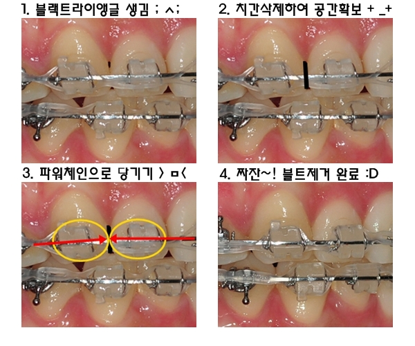 30.킬본교정.jpg
