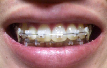 091221-0000.jpg