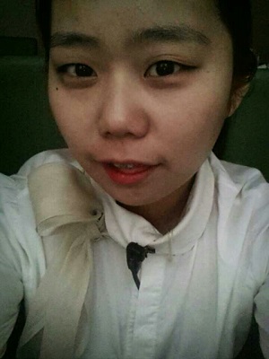 오라픽스 치아교정 포스팅(1).jpg