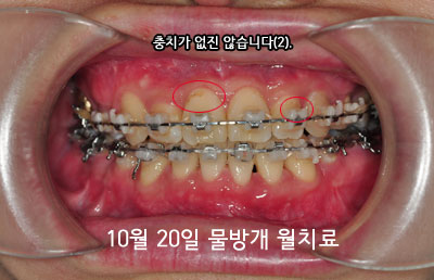 201510junghhh.jpg