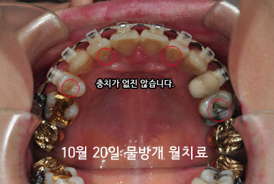 201510uphhh.jpg