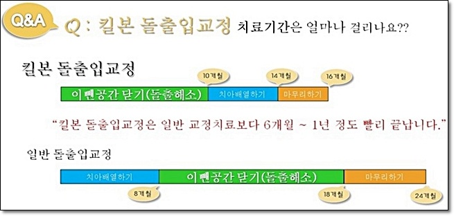 킬본---.jpg