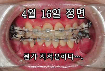 0416mulbangngngn.jpg