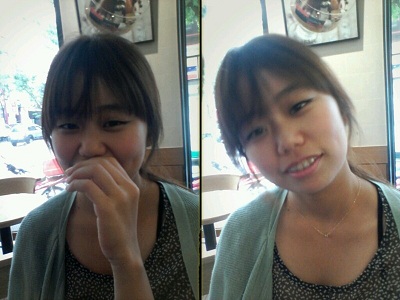 오라픽스 치아교정 포스팅 (2).jpg