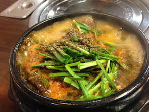 치아교정후기12.JPG