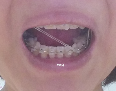 20150818_001436.jpg
