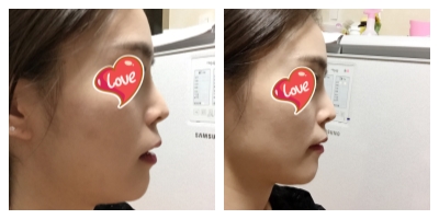 옆모습1.jpg