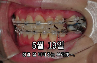 lefth0519.jpg
