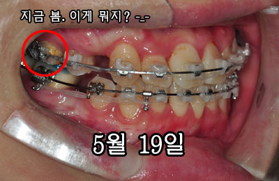 righth0519.jpg