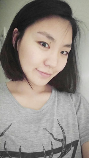 치아교정후기7.jpg