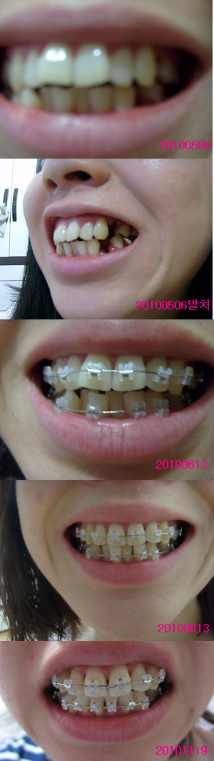 20101120205846_39896715.jpg