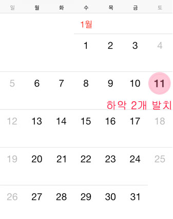 치아교정후기2.jpg
